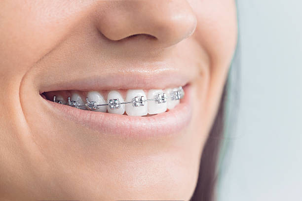 Best Veneers and Lumineers  in Bonneauville, PA